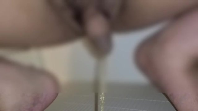 Peeled after the phimosis peeed