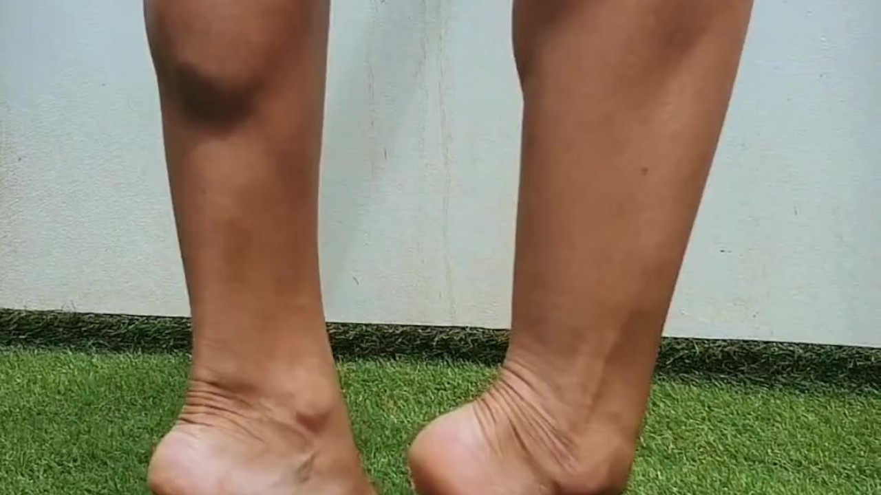 Calves and legs