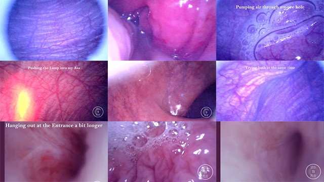 COMPILATION: Endoscope in my Dick, Ass and Bladder