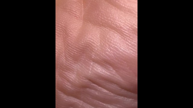 Sweaty Feet Upclose