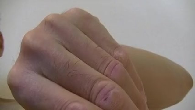 左腕を映した様子