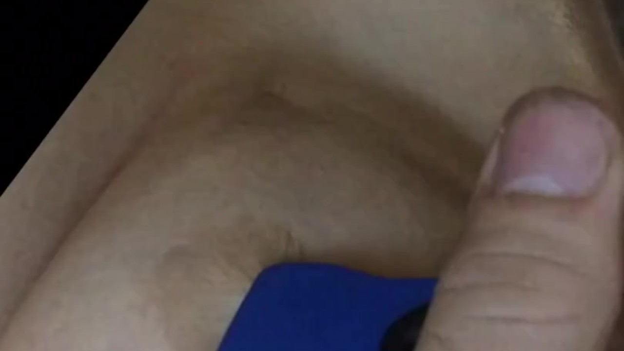 Tortured tits